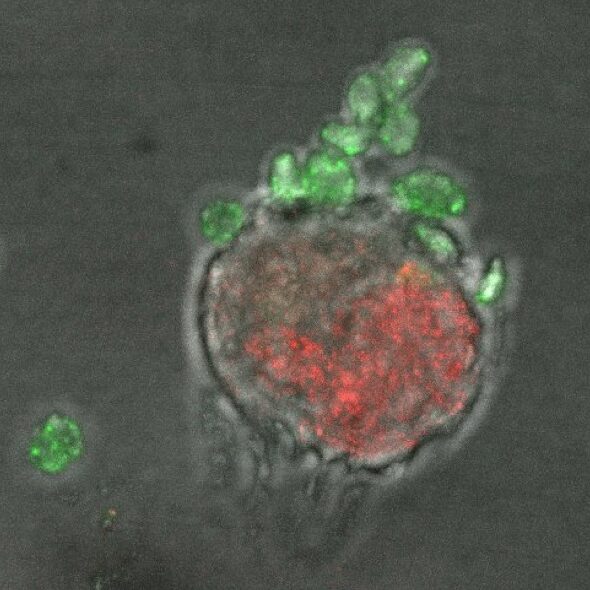 CROSSTALK BETWEEN PLATELETS AND TUMOR CELLS